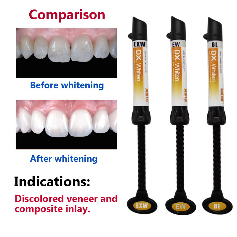 วัสดุวีเนียร์เคลือบฟันชนิดเรซิ - Lighting Jockey บทวิจารณ์และราคา